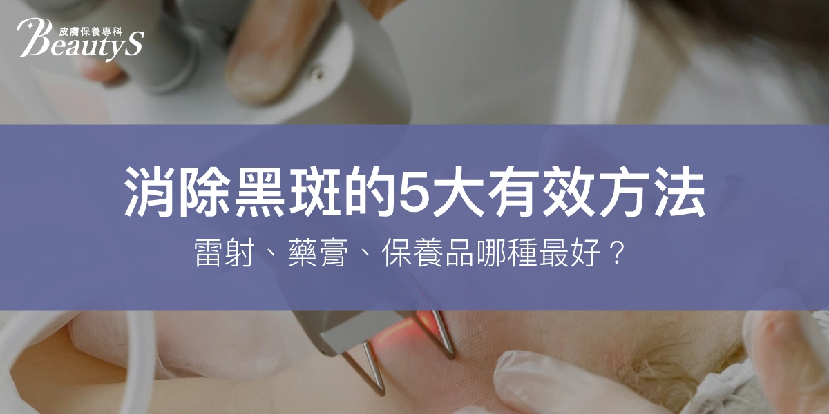 消除黑斑的5大有效方法：雷射、藥膏、保養品哪種最好？
