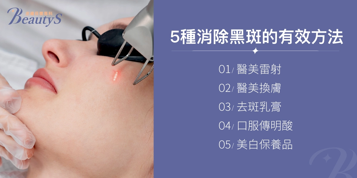 5種消除黑斑的有效方法:醫美雷射、醫美換膚、去斑乳膏、口服傳明酸、美白保養品