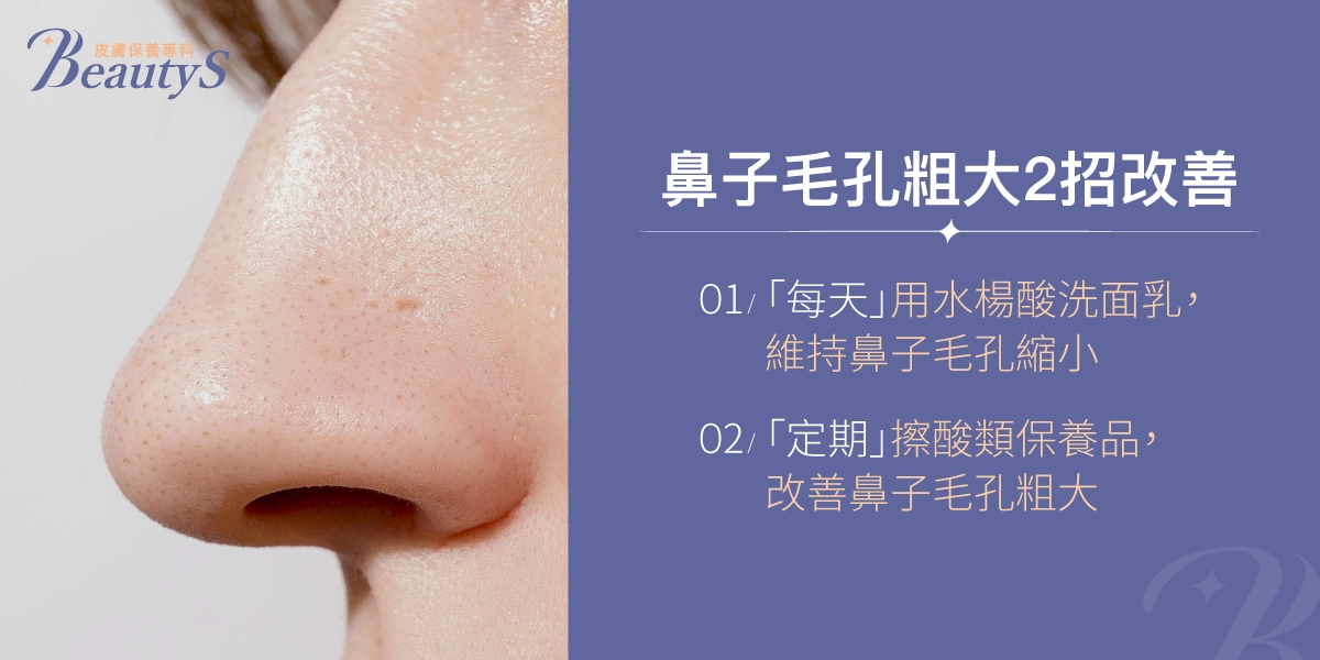 鼻子毛孔粗大2招改善:「每天」用水楊酸洗面乳,維持鼻子毛孔縮小、「定期」擦酸類保養品,改善鼻子毛孔粗大