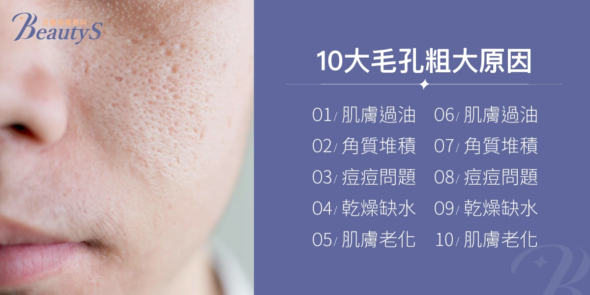 10大毛孔粗大原因:肌膚過油、角質堆積、痘痘問題、乾燥缺水、肌膚老化、太陽照射、彩妝粉底、皮膜受損、空氣汙染、基因遺傳
