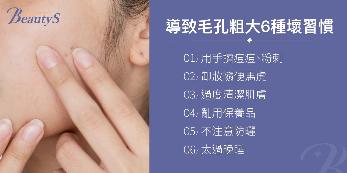 導致毛孔粗大6種壞習慣:用手擠痘痘、粉刺、卸妝隨便馬虎、過度清潔肌膚、亂用保養品、不注意防曬、太過晚睡