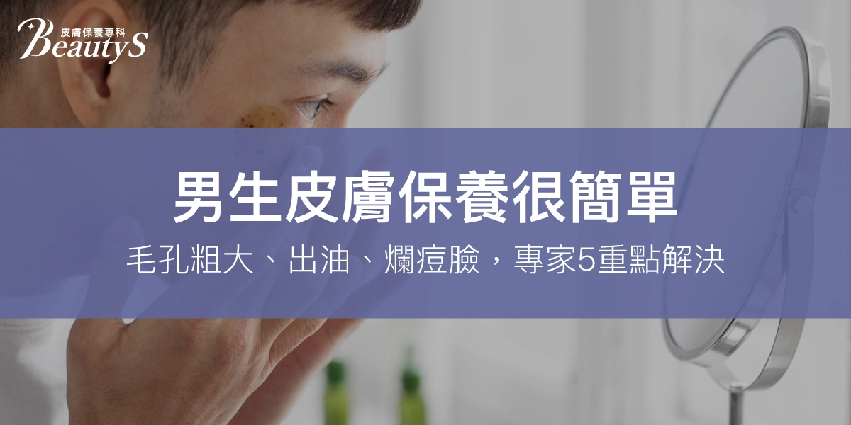 男生皮膚保養很簡單!毛孔粗大、出油、爛痘臉,專家5重點解決!