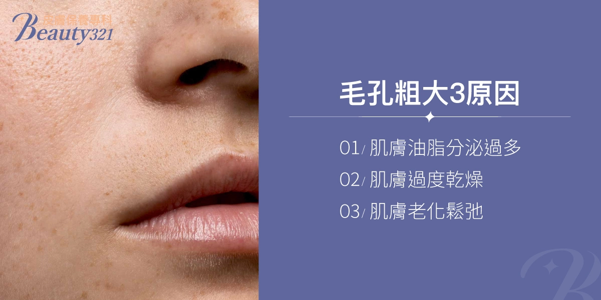 毛孔粗大3原因,包括:肌膚油脂分泌過多、肌膚過度乾燥、肌膚老化鬆弛。