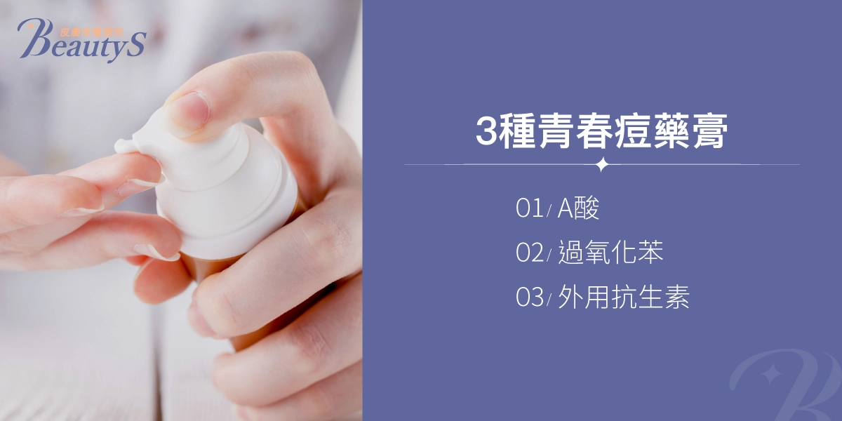 3種青春痘藥膏:A酸、過氧化苯、外用抗生素