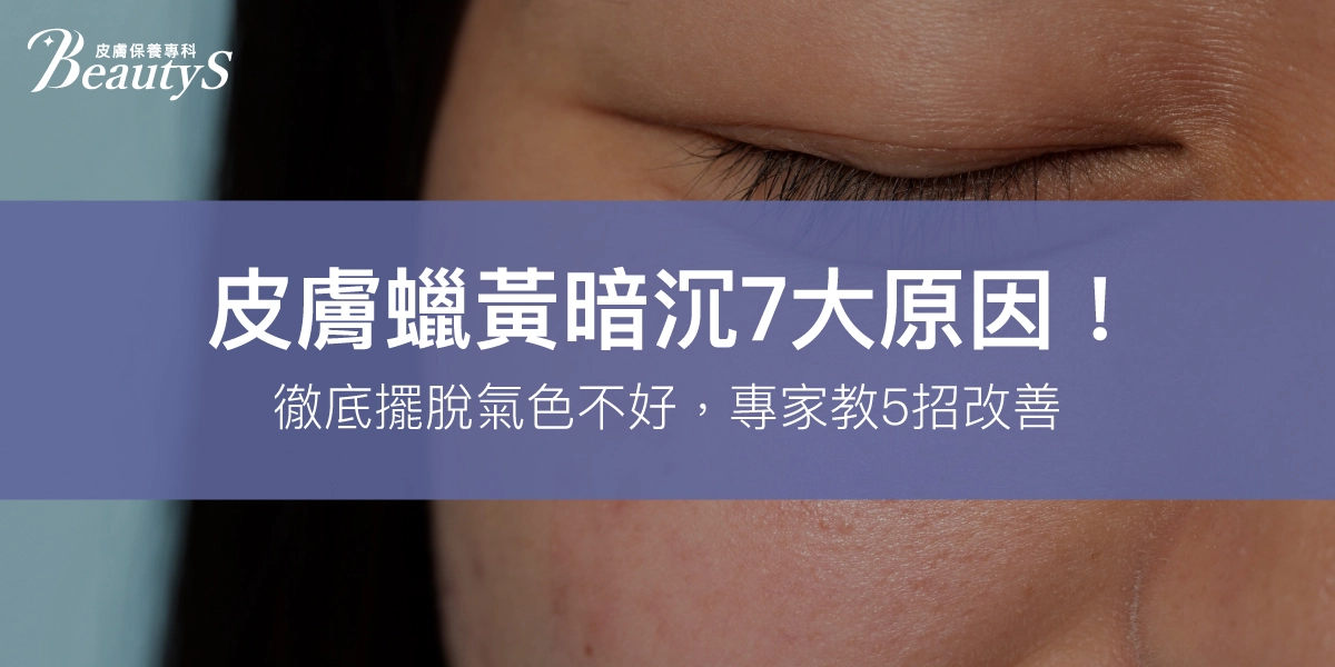 皮膚蠟黃暗沉7大原因！徹底擺脫氣色不好，專家教5招改善！