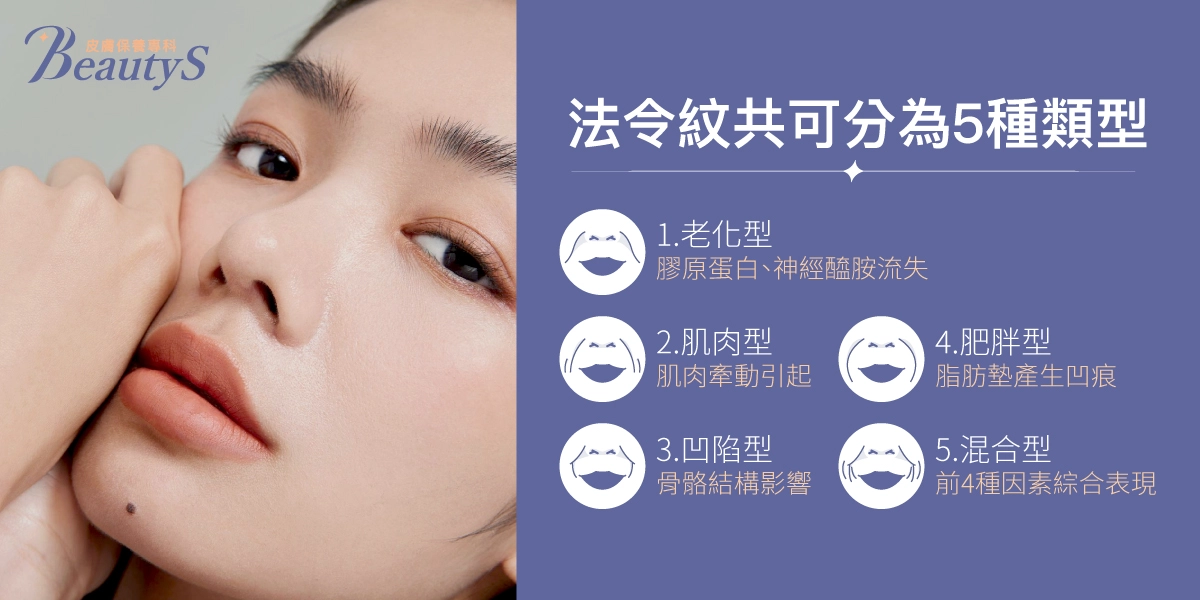 法令紋共可分為5種類型：老化型：膠原蛋白、神經醯胺流失、肌肉型：肌肉牽動引起、凹陷型：骨骼結構影響、肥胖型：脂肪墊產生凹痕、混合型：前4種因素綜合表現