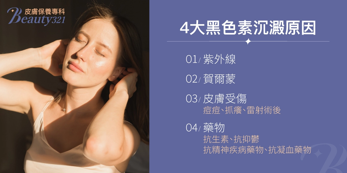 4大黑色素沉澱原因:紫外線、荷爾蒙(原文誤作「質爾蒙」)、皮膚受傷(痘痘/抓癢/雷射術後)、藥物(抗生素/抗抑鬱藥/抗精神疾病藥物/抗凝血藥物)。