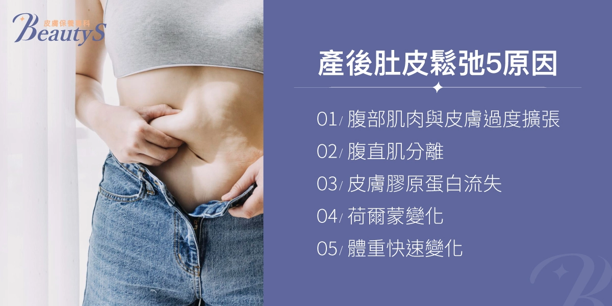 產後肚皮鬆弛的五大原因:腹部肌肉與皮膚過度擴張、腹直肌分離、皮膚膠原蛋白流失、荷爾蒙變化、體重快速變化。