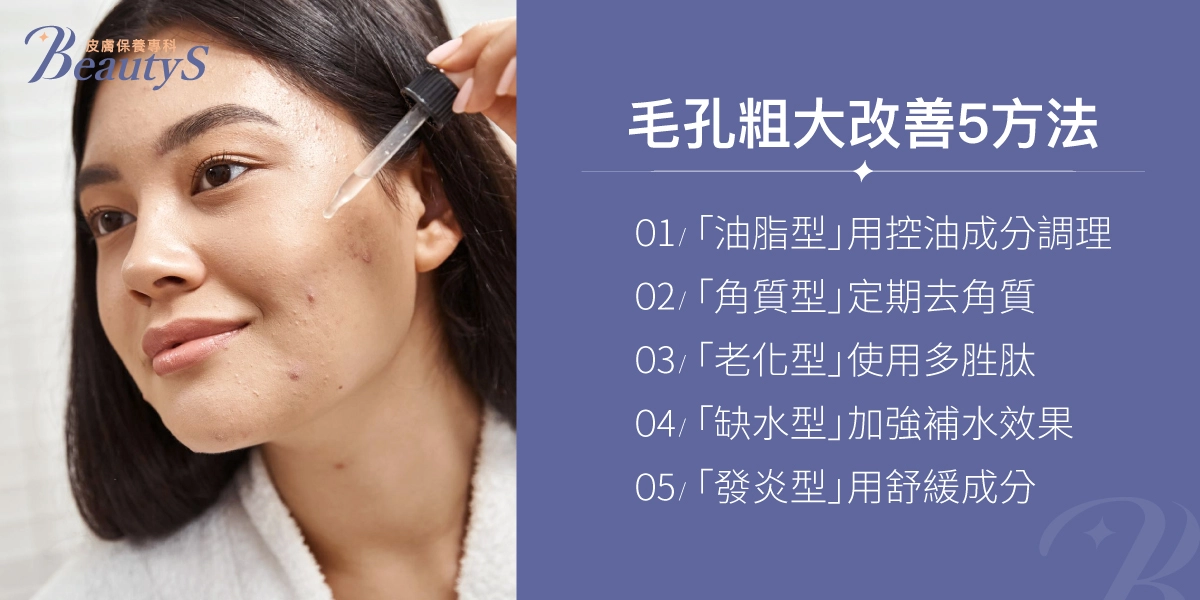 毛孔粗大改善5方法:「油脂型」用控油成分調理、「角質型」定期去角質、「老化型」使用多胜肽、「缺水型」加強補水效果、「發炎型」用舒緩成分