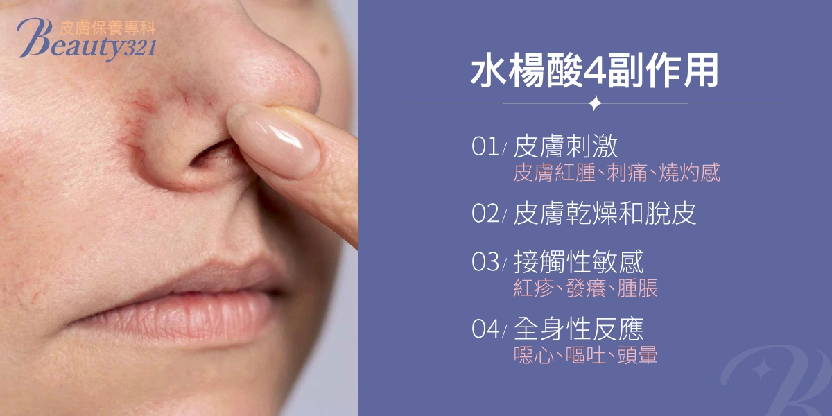 水楊酸4大副作用:皮膚刺激、乾燥脫皮、接觸性敏感、全身性反應。