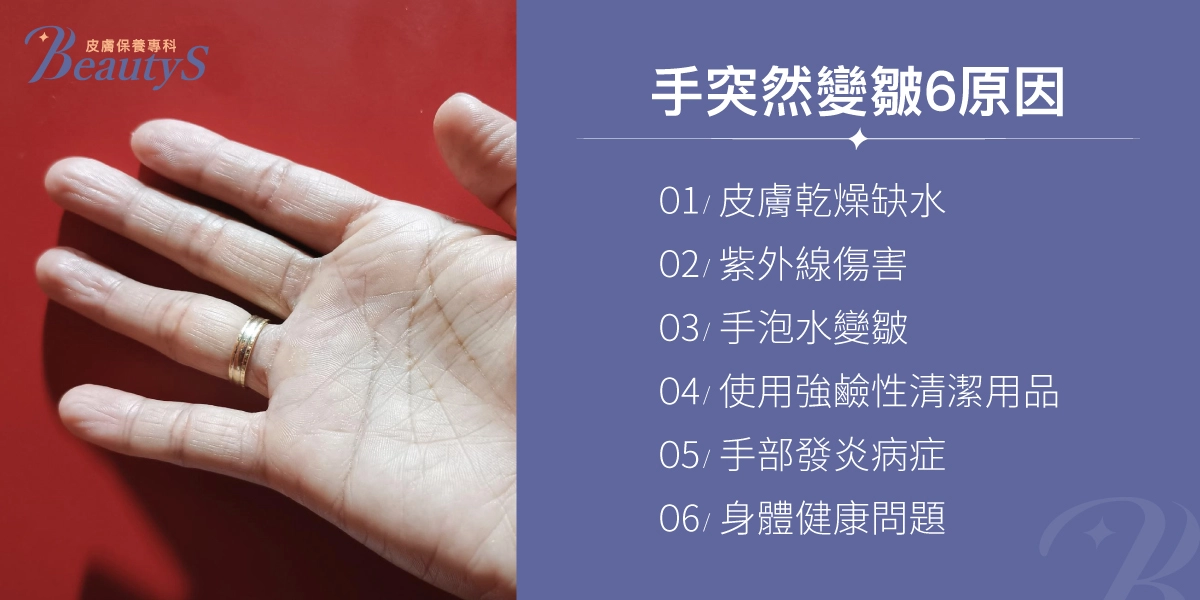 手突然變皺的六大原因：皮膚乾燥缺水、紫外線傷害、手泡水變皺、使用強鹼性清潔用品、手部發炎病症、身體健康問題。