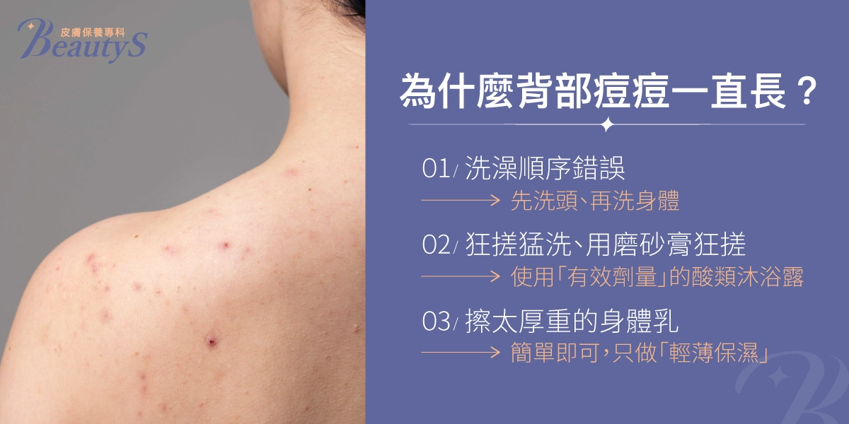 背痘一直反覆長？有可能是：洗澡順序錯誤、狂搓猛洗、用磨砂膏狂搓、擦太厚重的身體乳