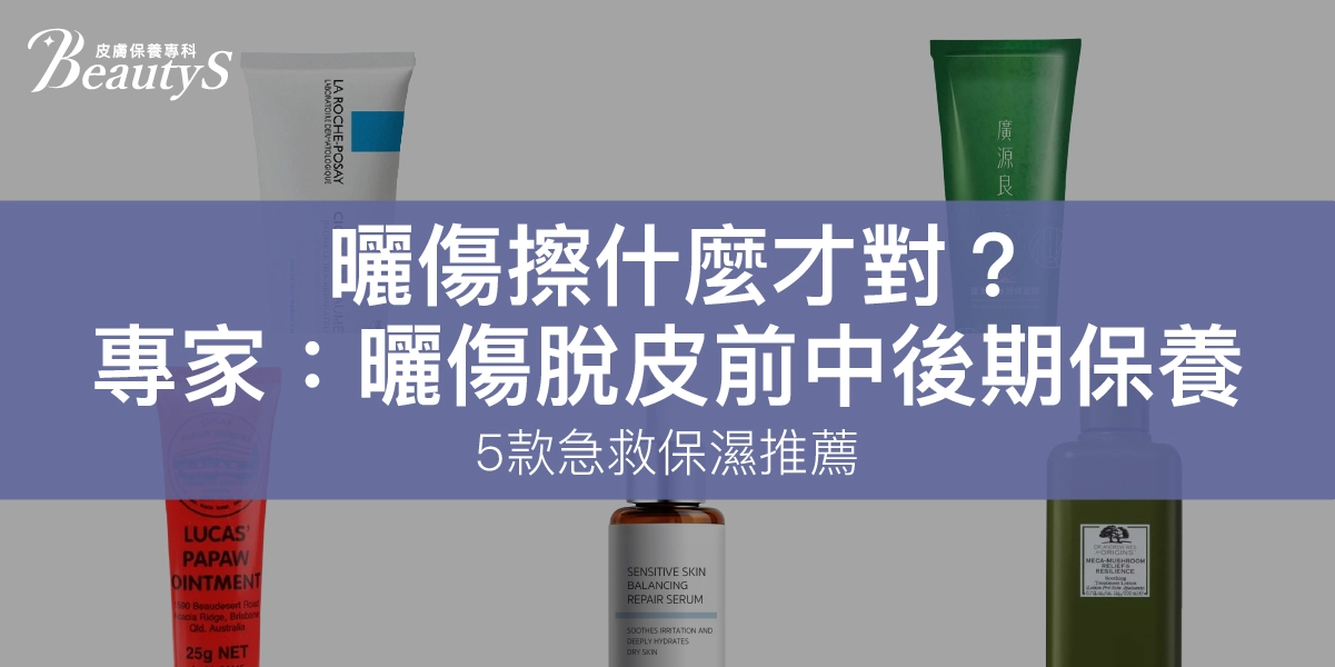 treat sunburn